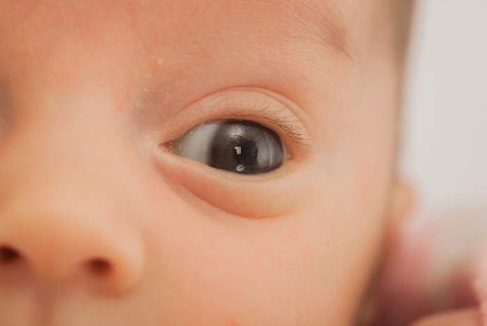 赤ちゃんの目